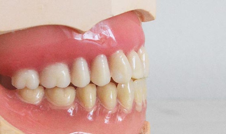 Paura del dentista: come superare l’ansia e il timore Paura del dentista: come superare l’ansia e il timore